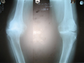 coimbatore-orthopaedic-joint-replacement-maternity-child-welfare-centre-india